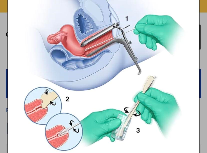 Rahim Ağzı (Serviks) Kanseri Taraması Nasıl Yapılır?