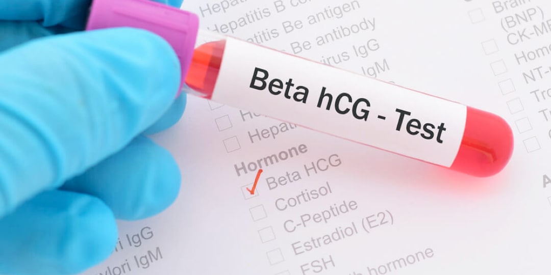 Beta HCG Nedir?