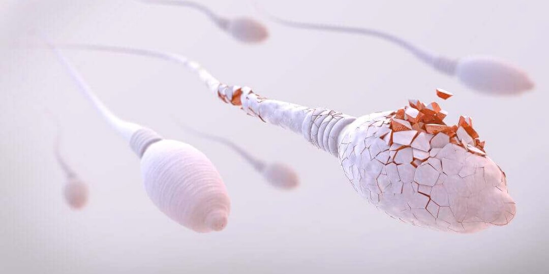 Tüp Bebek Tedavisinde Sperm Seçimi